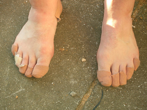 walking for charity - Clive's feet