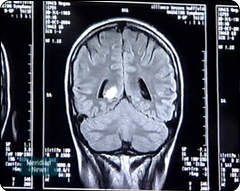 Meg's brain scan