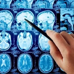 Exploring New Drug Targets in High Grade Glioma – Online Focus Group July 10th 2.00pm