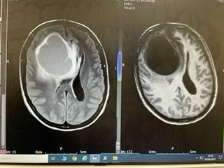Jenny's scan