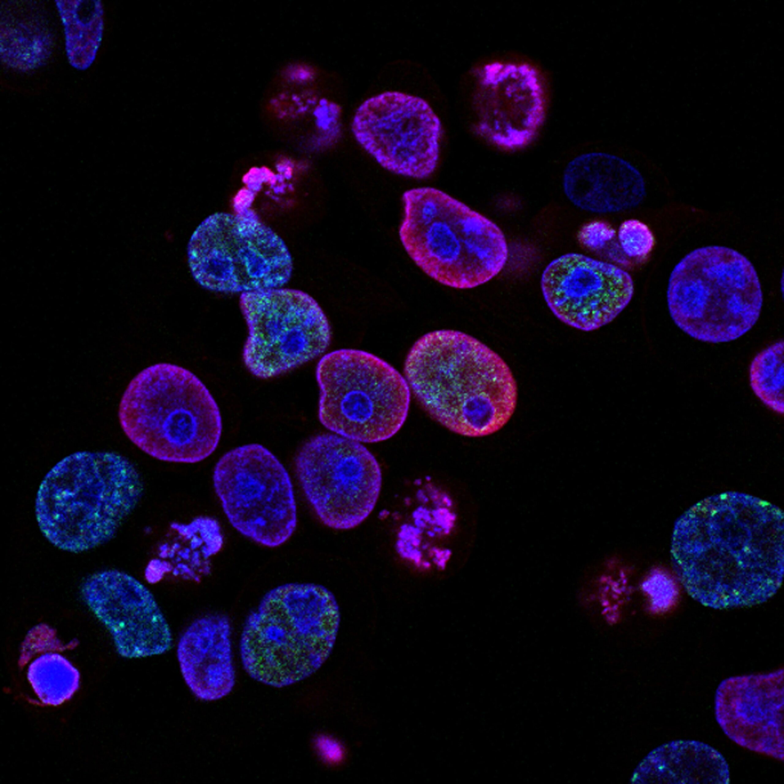 Cell-based immunotherapy treatment
